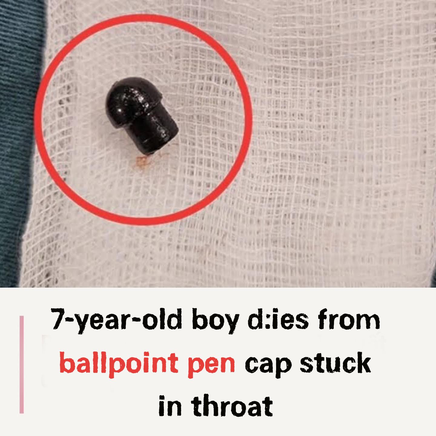 7-year-old boy d:ies from ballpoint pen cap stuck in throat